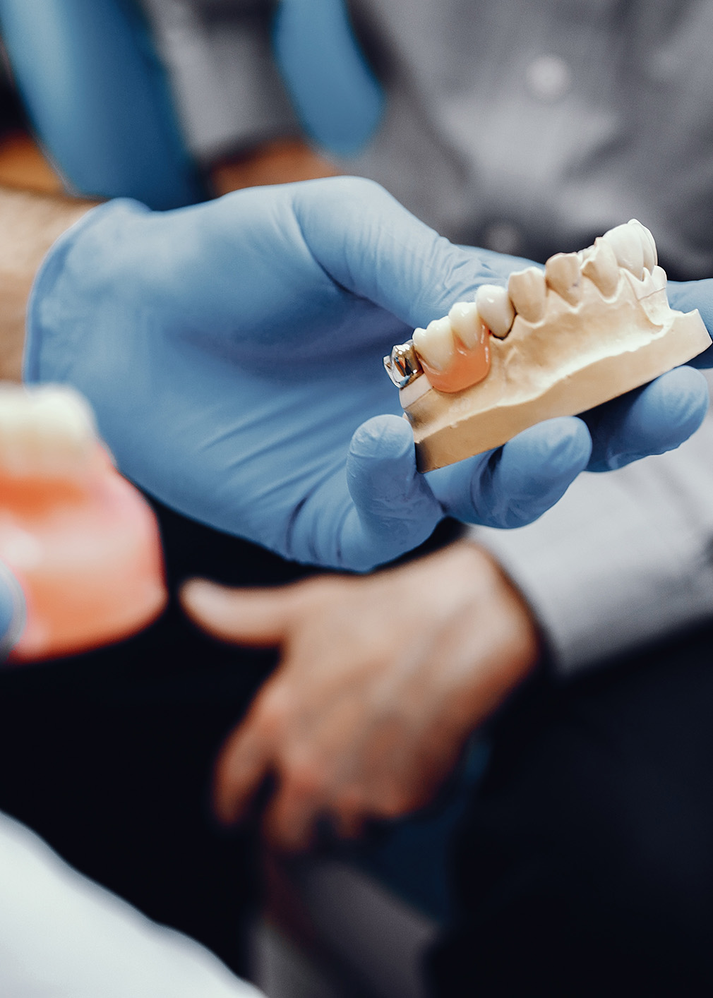 Edmonton denture clinic All-On-4 Dental Implants process